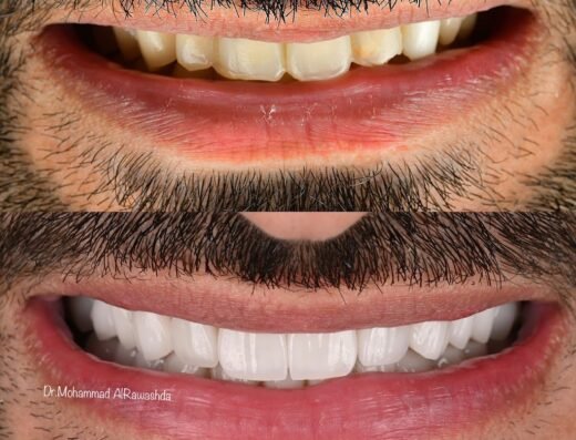 Berlin Medical Center. – dental clinic .عيادة د.محمد الرواشدة لعلاج وتجميل الاسنان