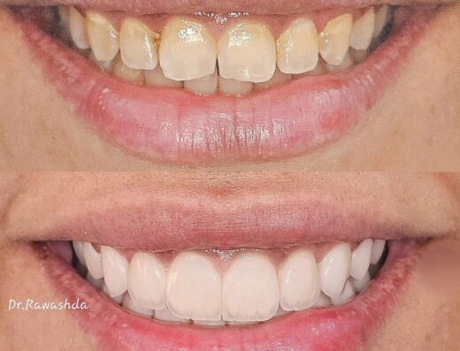 Berlin Medical Center. – dental clinic .عيادة د.محمد الرواشدة لعلاج وتجميل الاسنان