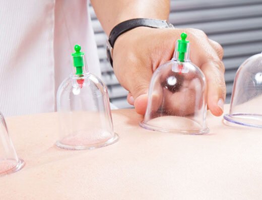 Cupping.Hijama. Dr. Mustafa Adoos | د. مصطفى عدّوس للطب العام والحجامة(General Medicine)